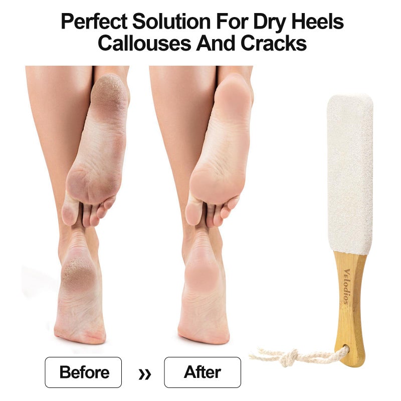 Velodios Foot File Foot Scrubber Pedicure, Pumice Stone for Feet, 2 Pack Professional Foot Scrubber Remove Cracked Heels,Dead Skin,Corn,Scraper File Foot Care Foot Rasp Massage Brush Tools Kit for Men/Women - Image 4